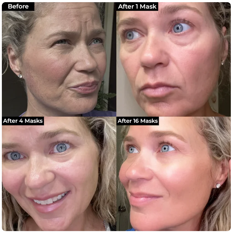 4PCS Bio Collagen Face Mask - Deep Hydrating Firming